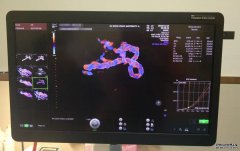 孕妈咪肚子里的「星辰大海」，每一张都很震撼……
